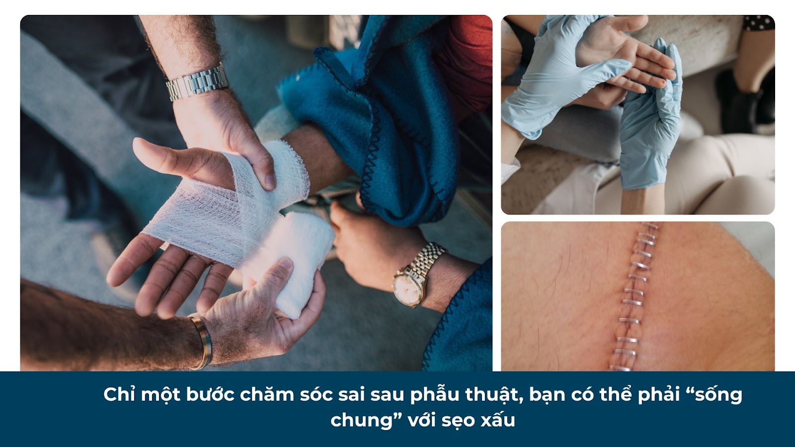 Chăm sóc vết thương: Hướng dẫn hiệu quả để hồi phục nhanh chóng và an toàn