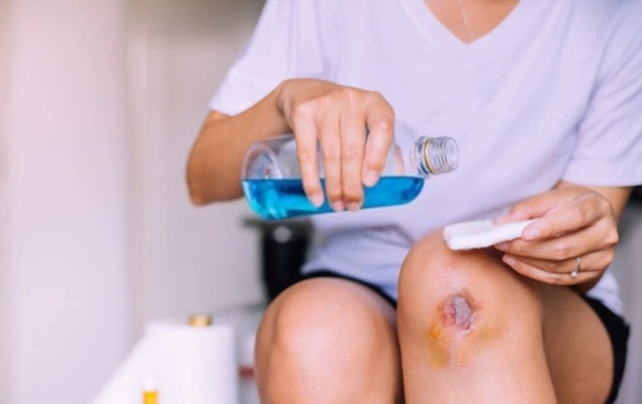 Môi trường ẩm tối ưu - Chìa khóa vàng trong chăm sóc và phục hồi vết thương