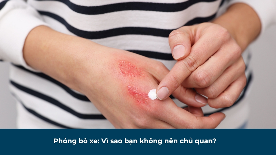 Phỏng bô xe: Xử lý và phòng ngừa biến chứng ngay từ ngày đầu