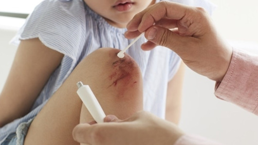 Lựa chọn thuốc bôi đúng cách - cho vết thương nhanh lành và tránh biến chứng