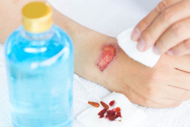 HemaHeal – Giải pháp hỗ trợ lành thương hiệu quả sau khi rửa vết thương