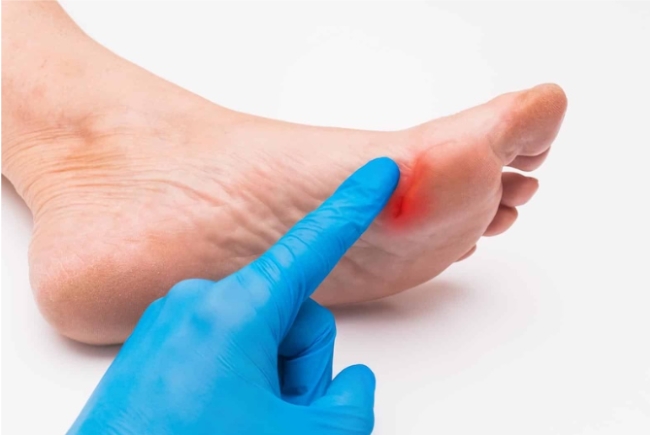 HemaHeal: Giải pháp đột phá cho những vết thương lâu lành