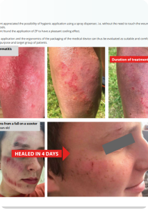 NGHIÊN CỨU PMCF PMCFHS 2021